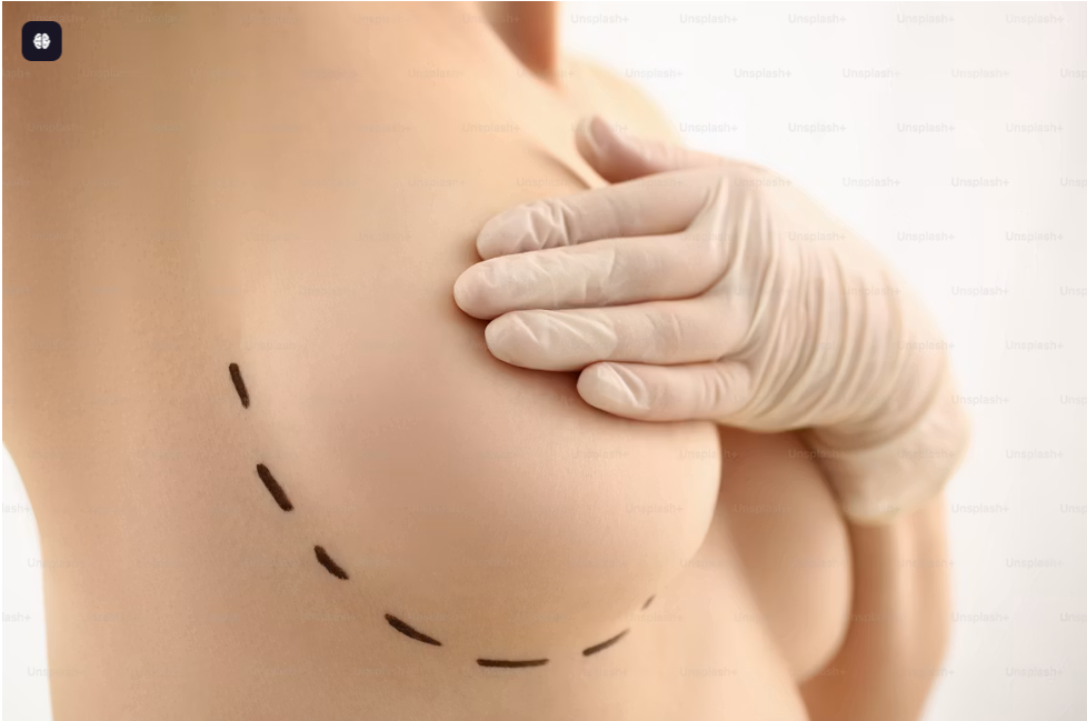 Plastic Surgery Results 4
